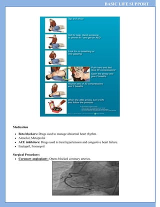 BASIC LIFE SUPPORT
Medication
 Beta blockers: Drugs used to manage abnormal heart rhythm.
 Atenolol, Metoprolol
 ACE inhibitors: Drugs used to treat hypertension and congestive heart failure.
 Enalapril, Fosinopril
Surgical Procedure:
 Coronary angioplasty: Opens blocked coronary arteries.
 