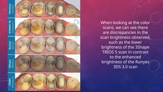 When looking at the color
scans, we can see there
are discrepancies in the
scan brightness observed,
such as the lower
brightness of the 3Shape
TRIOS 5 scan in contrast
to the enhanced
brightness of the Runyes
3DS 3.0 scan
 