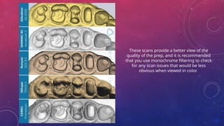 These scans provide a better view of the
quality of the prep, and it is recommended
that you use monochrome filtering to check
for any scan issues that would be less
obvious when viewed in color.
 