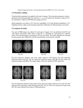 An intensity based medical image registration using genetic algorithm | PDF