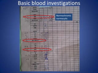 Basic blood investigations
                Normochromic
                normocytic
 
