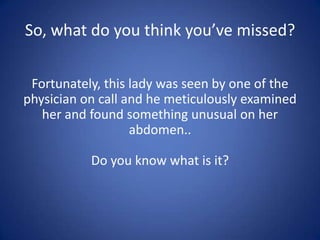 So, what do you think you’ve missed?

 Fortunately, this lady was seen by one of the
physician on call and he meticulously examined
   her and found something unusual on her
                   abdomen..

           Do you know what is it?
 