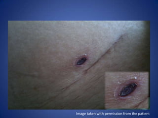 Image taken with permission from the patient
 