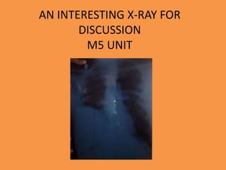 AN INTERESTING X-RAY FOR
DISCUSSION
M5 UNIT
 