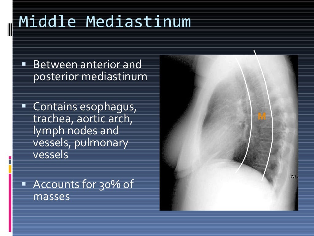 CXR Lung Mass Mediastinal Mass cxr-lung-mass-mediastinal-mass