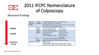 2011 IFCPC Nomenclature
of Colposcopy
Abnormal Findings
MINOR
MAJOR
Suspicious
For CA
 