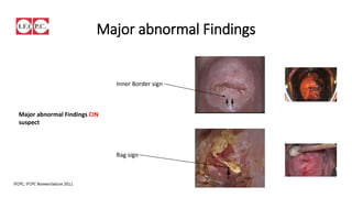 Minor abnormal Findings
Abnormal Findings (Normal vascular Pattern)
Sellors and Sankaranarayanan , 2003,
 