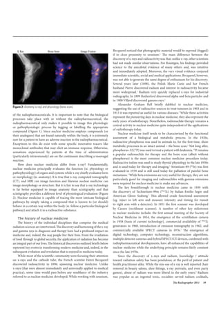 The Radiographer 2011 39
of the radiopharmaceuticals. It is important to note that the biological
processes take place with or without the radiopharmaceutical, the
radiopharmaceutical only makes it possible to image this physiologic
or pathophysiologic process by tagging or labelling the appropriate
compound (Figure 1). Since nuclear medicine employs compounds (or
their analogues) that are found naturally within the body, it is extremely
rare for a patient to have an adverse reaction to the radiopharmaceutical.
Exceptions to this do exist with some specific innovative tracers like
monoclonal antibodies that may elicit an immune response. Otherwise,
sensations experienced by patients at the time of administration
(particularly intravenously) are on the continuum describing a vasovagal
reaction.
How does nuclear medicine differ from x-ray? Fundamentally,
nuclear medicine principally evaluates the function (ie. physiology or
pathophysiology) of organs and systems while x-ray chiefly evaluates form
or morphology (ie. anatomy). It is true that x-ray, computed tomography
(CT), and MRI can image function and likewise nuclear medicine can
image morphology or structure. But it is fair to say that x-ray technology
is far better equipped to image anatomy than scintigraphy and that
scintigraphy provides a different level of physiological evaluation (Figure
2). Nuclear medicine is capable of tracing the most intricate biological
pathways by simply taking a compound that is known to (or should)
behave in a certain way within the body (ie. follow a particular biological
pathway) and attach it to a radioactive substance.
The history of nuclear medicine
The history of the individual disciplines that comprise the medical
radiationsciencesareintertwined.Thediscoveryandharnessingofthex-ray
and gamma rays in diagnosis and therapy have had a profound impact on
medicine and, indeed, the way people live their lives. From the irradiation
of food through to global security, the application of radiation has become
an integral part of our lives. The historical discoveries outlined briefly below
represent key events in transforming modern medicine and, indeed, in the
subsequent evolution and revolution that is enjoyed in medicine today.
While most of the scientific community were focusing their attention
on x-rays and the cathode tube, the French scientist Henri Becquerel
discovered radioactivity in 1896; spawning nuclear medicine. Unlike
x-rays (that were almost immediately and universally applied to medical
practice), some time would pass before any semblance of the industry
referred to as nuclear medicine developed. While working with uranium,
Becquerel noticed that photographic material would be exposed (fogged)
if in close proximity to uranium.1
The main difference between the
discovery of x-rays and radioactivity was that, unlike x-ray, other scientists
had not made similar observations. For Roentgen, his findings provided
science to the anecdotal evidence of many others and, was intuitive
and immediately adopted. Moreover, the very visual evidence conjured
immediate scientific, social and medical applications. Becquerel, however,
was not able to generate the same degree of enthusiasm for his discovery.
Several years later (1898), the Polish Marie Curie and her French
husband Pierre discovered radium and interest in radioactivity became
more widespread.1
Radium very quickly replaced x-rays for industrial
radiography. In 1899 Rutherford discovered alpha and beta particles and
in 1900 Villard discovered gamma rays.1
Alexander Graham Bell briefly dabbled in nuclear medicine,
suggesting the use of radioactive sources to treat tumours in 1903 and in
1913 it was reported as useful for various diseases.1
While these activities
represent the pioneering days in nuclear medicine, they also represent the
early years of radiotherapy. Nonetheless, radionuclide therapy remains a
central activity in nuclear medicine quite independent of the applications
of radiotherapy today.
Nuclear medicine itself tends to be characterised by the functional
assessment of a biological and metabolic process. In the 1920s,
radioactive phosphorus was used in animals to, for the first time, show
metabolic processes in an intact animal – the bone scan.1
Not long after,
phosphorus-32 (32
P) was used to treat a patient with leukemia. 32
P remains
a popular radionuclide for therapy and the bone scan (albeit without
phosphorus) is the most common nuclear medicine procedure today.
Radioactive iodine was used to study thyroid physiology in the late 1930s
and is used today for therapy and imaging.1
Strontium-89 (89
Sr) was first
evaluated in 1939 and is still used today for palliation of painful bone
metastases.1
While beta emissions are very useful for therapy, they are not
particularly good for imaging and radionuclides with gamma emissions
were required for nuclear medicine to make any advances.
The key breakthrough in nuclear medicine came in 1939 with
the discovery of Technetium-99m (99m
Tc) by Italian Emilio Segre and
American Glenn Seaborg.1
This allowed crude functional assessment
(eg. inject in left arm and measure intensity and timing for transit
to right arm with a detector). In 1951 the first scanner was developed
by Cassen (rectilinear scanner). A number of other key milestones
in nuclear medicine include; the first annual meeting of the Society of
Nuclear Medicine in 1954, the emergence of the scintillation camera
in 1958 (basis of current technology), commercial availability of 99m
Tc
generators in 1960, introduction of emission tomography in 1962, and
commercially available SPECT cameras in 1976.1
The emergence of
digital technology, computer technology, reconstruction algorithms,
multiple detector cameras and hybrid SPECT/CT devices, combined with
radiopharmaceutical developments, have all enhanced the capabilities of
nuclear medicine while the underlying principle remains fairly constant
since the late 1970s.
Since the discovery of x-rays and radium, knowledge / attitude
toward radiation safety has been pendulous; at the peril of patient and
health practitioner alike. While the mis-use of x-ray is well reported (hair
removal in beauty salons, shoe fittings, x-ray portraits, and even party
games), abuse of radium was more liberal in the early years.2
Radium
was popular as an ingested tonic, socialites served radium cocktails,
Figure 2: Anatomy (x-ray) and physiology (bone scan).
 