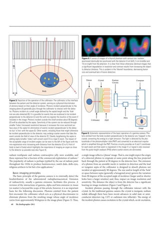 40 The Radiographer 2011
radium toothpaste and radium contraceptive jelly were available, and
these represent but a fraction of the commercial exploitation of radium.2
The popularity of radium is perhaps typified by the use of radium paint
throughout the 1920s to produce luminescence; watch dials, dolls eyes,
religious artifacts to list but a few applications.2
Basic imaging principles
The basic principle of the gamma camera is to externally detect the
biodistribution of the administered radiopharmaceutical. Emission
of radioactivity, usually a gamma emission, facilitates this process. A
revision of the interactions of gamma, alpha and beta emission in tissue
(or matter) is beyond the scope of this article, however, it is an important
basis for the following discussion. Photons emitted from the patient
first encounter the collimator which acts as a physical discriminator to
eliminate photons from the resulting image whose angle of incidence
varies from approximately 90degrees to the image plane (Figure 3). Thus,
a single image reflects a ‘planar’ image. That is, one might expect the origin
of a detected photon to originate at some point along the line projected
back through the patient at 90 degrees to the detector face. The emission
of a photon from an unstable nuclei is random in direction and the lead
or tungsten septa of the collimator is designed to absorb photons not
incident at approximately 90 degrees. The size and/or length of the ‘hole’
or space between septa (generally a hexagonal array) govern the variation
from 90 degrees of the accepted angle of incidence (larger and/or shorter
holes have a larger window) and, thus, impact on image resolution and
sensitivity. The distance the object is from the detector has a significant
bearing on image resolution (Figure 3 and Figure 4).
Incident photons passing through the collimator interact with the
crystal. In the traditional gamma camera the crystal is inorganic sodium
iodide although there have been recent advances in solid state or semi-
conductor detectors (eg. CZT or cadmium zinc telluride). The energy of
the incident photon causes excitation in the crystal which, on de-excitation,
Figure 4: A series of images of a thyroid phantom with various size ‘nodules’,
positioned identically but positioned with the detector 0 cm (left), 5 cm (middle) and
10 cm (right) from the phantom. It is clear from these otherwise identical images that
a significant degradation in resolution and contrast results from increasing the object
to detector distance. This is evident in the ‘blurred’ boundaries, decreasing lesion
size and eventual lack of lesion detection.
Figure 5: Schematic representation of the basic operation of a gamma camera. Pho-
tons emitted from the body incident perpendicular to the detector are ‘trapped’ in the
crystal; converting the energy to a light emission. The light is detected by the pho-
tocathode of the photomultiplier tube (PMT) and converted to an electrical impulse
which is amplified through the PMT. Position circuitry provides an X and Y coordinate
for each event and that event is registered in the image if a Z signal is also received
from the pulse height analyser (PHA) where scatter events are eliminated.
Figure 3: Depiction of the operation of the collimator. The collimator is the interface
between the patient and the detector system; serving as a physical discriminator
of photons based on their angle of incidence. Photons incident perpendicular to the
imaging plane (A) generally pass through the collimator to interact with the detec-
tor. Photons incident at a small angle defined by the septal length and the ‘hole’
size are also detected (B). It is possible for events that are scattered to be incident
perpendicular to the detector (C) and this will mis-register the location of the event if
included in the image. Photons incident outside the small window about 90 degrees
(D) will be absorbed by the septa. Sensitivity of the system can be reduced through
smaller ‘holes’ (increased resolution) because it increases the cross sectional sur-
face area of the septa for elimination of events incident perpendicular to the detec-
tor but ‘in line’ with the septa (E). Other events, including those that might otherwise
be incident perpendicular to the detector, may undergo scatter events that take the
event outside the field of view of the detector (F). Clearly, lengthening the septa or
adding septa (smaller ‘holes’) will convert event B to a type D event. The impact of
the acceptable range of incident angles can be seen to the left of the figure with the
mis-registration error increasing with distance from the detector (G to H; front of
body to back of body) which highlights the importance of imaging an organ as close
to the detector as possible (see also Figure 4).
 