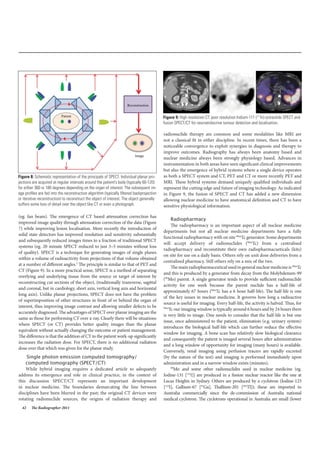 42 The Radiographer 2011
(eg. fan beam). The emergence of CT based attenuation correction has
improved image quality through attenuation correction of the data (Figure
7) while improving lesion localisation. More recently the introduction of
solid state detectors has improved resolution and sensitivity substantially
and subsequently reduced images times to a fraction of traditional SPECT
systems (eg. 20 minute SPECT reduced to just 3–5 minutes without loss
of quality). SPECT is a technique for generating images of single planes
within a volume of radioactivity from projections of that volume obtained
at a number of different angles.3
The principle is similar to that of PET and
CT (Figure 9). In a more practical sense, SPECT is a method of separating
overlying and underlying tissue from the source or target of interest by
reconstructing cut sections of the object, (traditionally transverse, sagittal
and coronal, but in cardiology, short axis, vertical long axis and horizontal
long axis). Unlike planar projections, SPECT does not have the problem
of superimposition of other structures in front of or behind the organ of
interest, thus improving image contrast and allowing smaller defects to be
accurately diagnosed. The advantages of SPECT over planar imaging are the
same as those for performing CT over x-ray. Clearly there will be situations
where SPECT (or CT) provides better quality images than the planar
equivalent without actually changing the outcome or patient management.
The difference is that the addition of CT to the patient work-up significantly
increases the radiation dose. For SPECT, there is no additional radiation
dose over that which was given for the planar study.
 Single photon emission computed tomography/
computed tomography (SPECT/CT)
While hybrid imaging requires a dedicated article to adequately
address its emergence and role in clinical practice, in the context of
this discussion SPECT/CT represents an important development
in nuclear medicine. The boundaries demarcating the line between
disciplines have been blurred in the past; the original CT devices were
rotating radionuclide sources, the origins of radiation therapy and
radionuclide therapy are common and some modalities like MRI are
not a classical fit in either discipline. In recent times, there has been a
noticeable convergence to exploit synergies in diagnosis and therapy to
improve outcomes. Radiography has always been anatomy based and
nuclear medicine always been strongly physiology based. Advances in
instrumentation in both areas have seen significant clinical improvements
but also the emergence of hybrid systems where a single device operates
as both a SPECT system and CT, PET and CT or more recently PET and
MRI. These hybrid systems demand uniquely qualified individuals and
represent the cutting edge and future of imaging technology. As indicated
in Figure 9, the fusion of SPECT and CT has added a new dimension
allowing nuclear medicine to have anatomical definition and CT to have
sensitive physiological information.
Radiopharmacy
The radiopharmacy is an important aspect of all nuclear medicine
departments but not all nuclear medicine departments have a fully
functional radiopharmacy with on site 99m
Tc generator. Some departments
will accept delivery of radionuclides (99m
Tc) from a centralised
radiopharmacy and reconstitute their own radiopharmacueticals (kits)
on site for use on a daily basis. Others rely on unit dose deliveries from a
centralised pharmacy. Still others rely on a mix of the two.
The main radiopharmaceutical used in general nuclear medicine is 99m
Tc
and this is produced by a generator from decay from the Molybdenum-99
(99
Mo) parent. A single generator tends to provide sufficient radionuclide
activity for one week because the parent nuclide has a half-life of
approximately 67 hours (99m
Tc has a 6 hour half-life). The half-life is one
of the key issues in nuclear medicine. It governs how long a radioactive
source is useful for imaging. Every half-life, the activity is halved. Thus, for
99m
Tc our imaging window is typically around 6 hours and by 24 hours there
is very little to image. One needs to consider that the half-life is but one
issue, once administered to the patient, elimination (e.g. urinary system)
introduces the biological half-life which can further reduce the effective
window for imaging. A bone scan has relatively slow biological clearance
and consequently the patient is imaged several hours after administration
and a long window of opportunity for imaging (many hours) is available.
Conversely, renal imaging using perfusion tracers are rapidly excreted
(by the nature of the test) and imaging is performed immediately upon
administration and in a narrow window exists (minutes).
99
Mo and some other radionuclides used in nuclear medicine (eg.
Iodine-131 [131
I]) are produced in a fission nuclear reactor like the one at
Lucas Heights in Sydney. Others are produced by a cyclotron (Iodine-123
[123
I], Gallium-67 [67
Ga], Thallium-201 [201
Tl]); these are imported to
Australia commercially since the de-commission of Australia national
medical cyclotron. The cyclotrons operational in Australia are small (lower
Figure 8: Schematic representation of the principals of SPECT. Individual planar pro-
jections are acquired at regular intervals around the patient’s body (typically 60-120)
for either 360 or 180 degrees depending on the organ of interest. The subsequent im-
age profiles are fed into the reconstruction algorithm (typically filtered backprojection
or iterative reconstruction) to reconstruct the object of interest. The object generally
suffers some loss of detail over the object like CT or even a photograph.
Figure 9: High resolution CT, poor resolution Indium-111 (111
In) octreotide SPECT and
fusion SPECT/CT for neuroendocrine tumour detection and localisation.
 