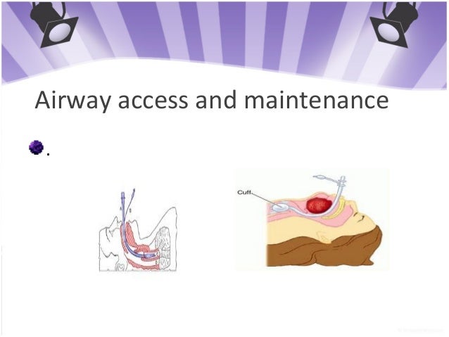 maintenance and reversal of anaesthesia Complete reversal of especially rocuronium-induced for maintenance of anaesthesia (133) and eleven cases as total intravenous anaesthesia (propofol/ opioid. maintenance and reversal of anaesthesia Complete reversal of especially rocuronium-induced for maintenance of anaesthesia (133) and eleven cases as total intravenous anaesthesia (propofol/ opioid.