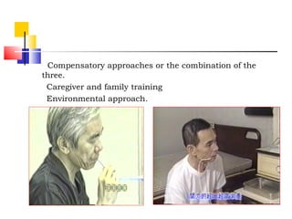 Compensatory approaches or the combination of the
three.
Caregiver and family training
Environmental approach.
 