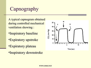 An Introduction To Surgical Icu | PPT