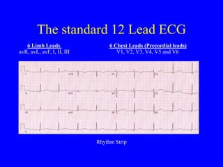 AN INTRODUCTION TO THE 12 LEAD ECG IN MEDICINE | PPT
