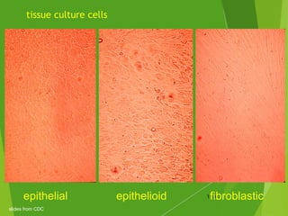 tissue culture cells
118epithelial epithelioid fibroblastic
slides from CDC
 