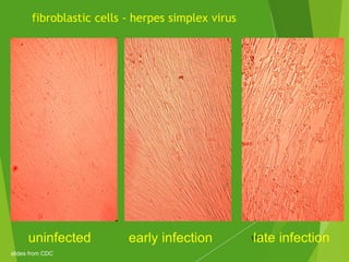 fibroblastic cells - herpes simplex virus
121uninfected early infection late infection
slides from CDC
 