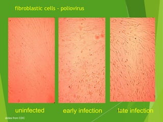 fibroblastic cells - poliovirus
122uninfected early infection late infection
slides from CDC
 