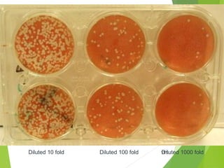 126Diluted 10 fold Diluted 100 fold Diluted 1000 fold
 