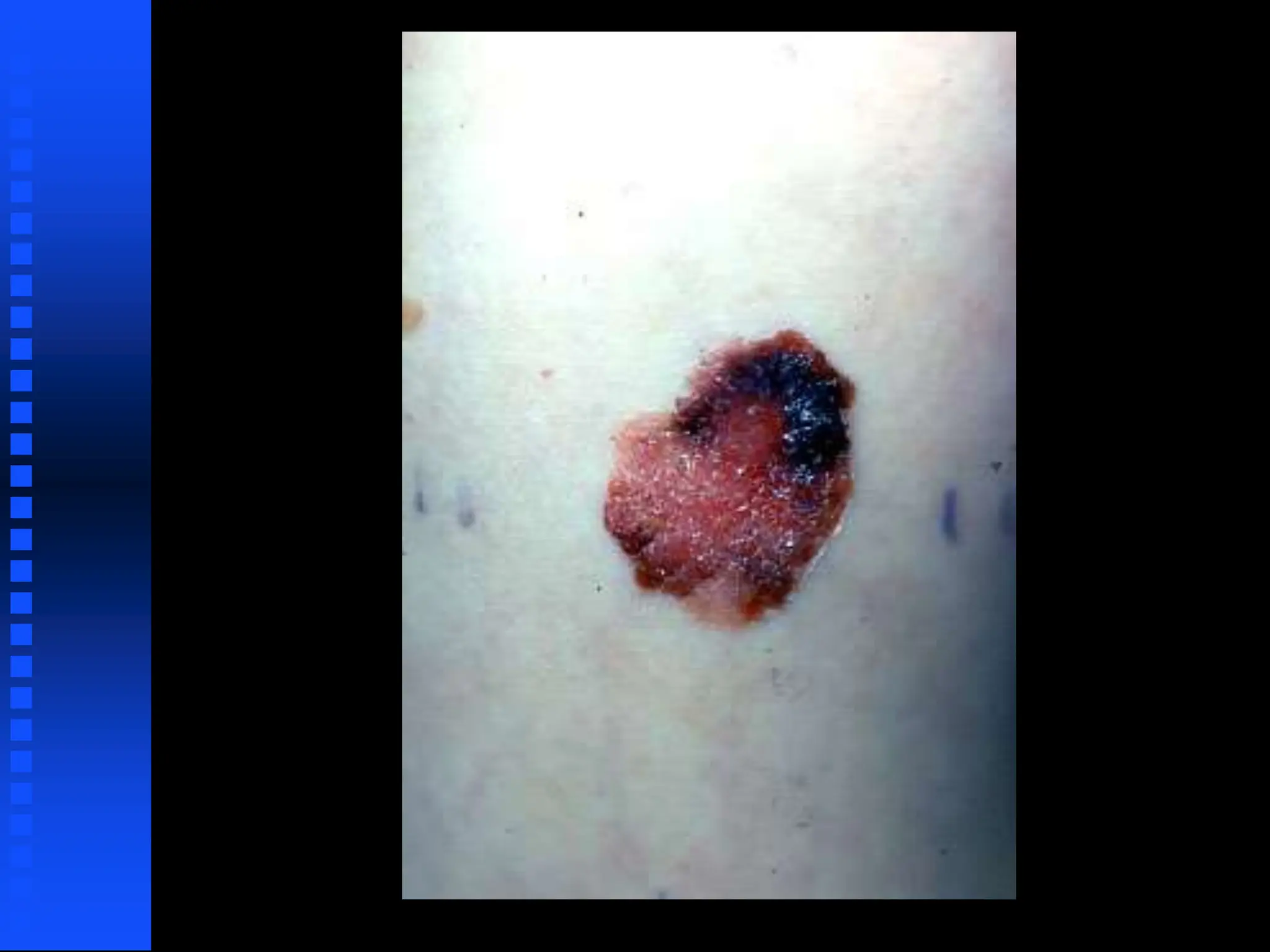 an introduction to dermatology including rash.ppt