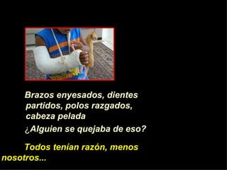 Brazos enyesados, dientes partidos, polos razgados, cabeza pelada   ¿ Alguien se quejaba de eso? Todos ten í an raz ón , menos nosotros... 