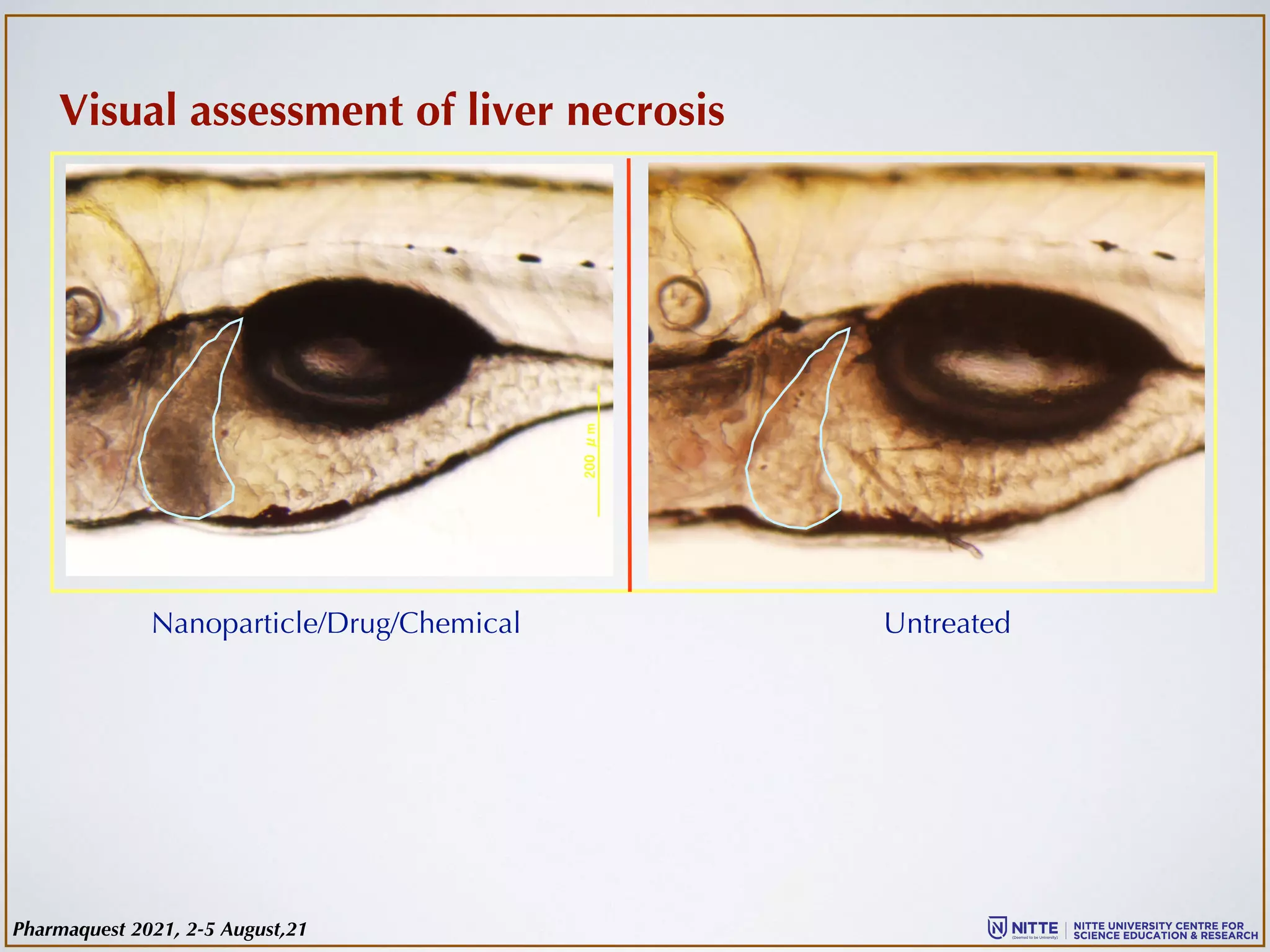 Visual assessment of liver necrosis
Nanoparticle/Drug/Chemical Untreated
Pharmaquest 2021, 2-5 August,21
 