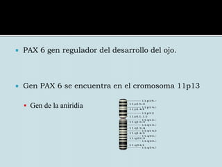 Función del IrisIncrementar la cantidad de luz que penetra en el ojo en la oscuridad Disminuirla cuando hay mucha luminosidadSu color da tonalidad a nuestros ojos AniridiaDescrita por Barratta en 1818 a la cual denominó irideremia haciendo referencia a su signo más aparente, la falta de iris. Siglo XX comienza a usarse la denominación actual