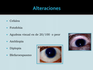 Alteración panocular bilateralIncidencia de 1: 64 000 – 96 000Sin predilección de sexo o raza conocida