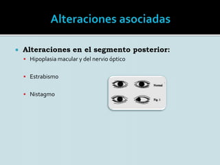 PAX 6 gen regulador del desarrollo del ojo.Gen PAX 6 se encuentra en el cromosoma 11p13Gen de la aniridia