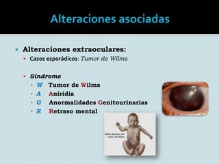 AlteracionesCefaleaFotofobia Agudeza visual es de 20/100 o peorAmbliopía DiplopíaBlefaroespasmo
