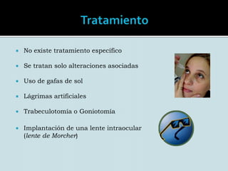 Alteraciones asociadasAlteraciones en el segmento posterior:Hipoplasia macular y del nervio óptico Estrabismo Nistagmo