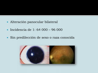 Cuerpo ciliarAnatomía del IrisRecubre por completo el cristalinoExcepto en la pupilaEs más grueso en la parte media y se adelgaza hacia su unión con el cuerpo ciliar y el borde de la pupila.