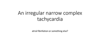 An irregular narrow complex
tachycardia
atrial fibrillation or something else?
 