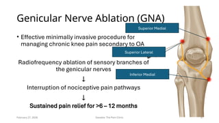 Who Responds to Genicular RFA in Knee OA? Ultrasound Synovial ...