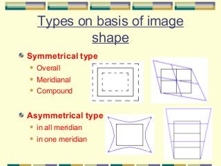 Types on basis of image
shape
Symmetrical type


Overall



Meridianal



Compound

Asymmetrical type


in all meridian



in one meridian

 