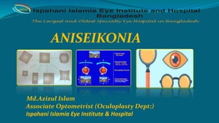 ANISEIKONIA
Md.Azizul Islam
Associate Optometrist (Oculoplasty Dept:)
Ispahani Islamia Eye Institute & Hospital
IIEI&H
 