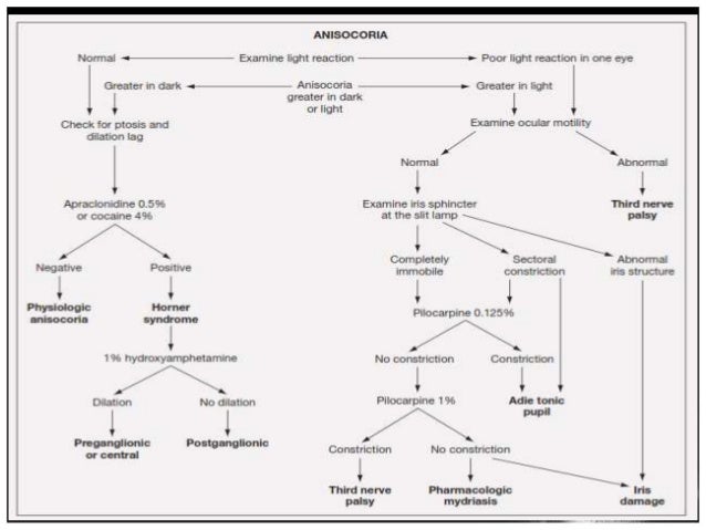 anisocoria definition anisocoria definition