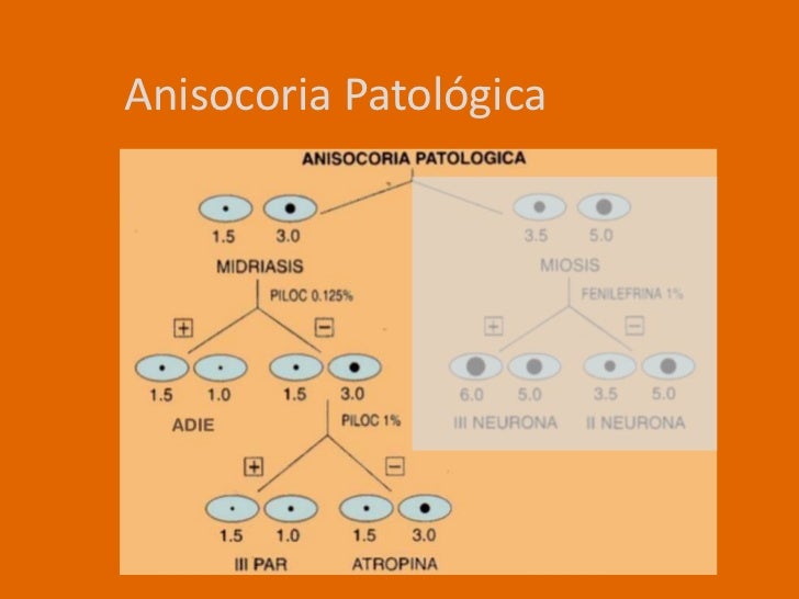 Anisocoria 2011