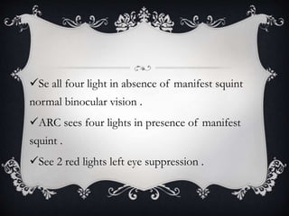 Se all four light in absence of manifest squint
normal binocular vision .
ARC sees four lights in presence of manifest
squint .
See 2 red lights left eye suppression .
 