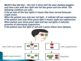 Worth's four dot test - this test is done with the wear diplopia goggles
and view a box with four light one red two green and one white. The
following condition are seen.
If the pt sees all the four lights it means they have normal binocular
single vision.
When the patient sees only two red light . It indicate left eye suppression.
If the patient sees only three green light it means reght eye suppression.
When patient sees three green light and two red lights it indicates
presence of alternating suppression.
If the patient sees five light (2 red and 3 green )these have diplopia.
 