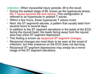 Myocardial Infarction by Anita Yadav | PPT