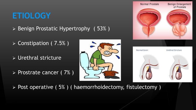 gabapentin acute urinary retention