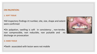 ON PALPATION:
1. SOFT TISSUE
All inspectory findings irt number, site, size, shape and extent
were confirmed
On palpation, swelling is soft in consistency , non-tender,
non compressible, non reducible, non pulsatile and no
discharge on provocation
2. HARD TISSUE
Teeth associated with lesion were not mobile
 