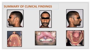 SUMMARY OF CLINICAL FINDINGS
 