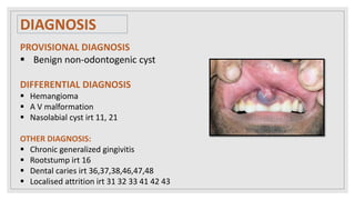 DIAGNOSIS
PROVISIONAL DIAGNOSIS
 Benign non-odontogenic cyst
DIFFERENTIAL DIAGNOSIS
 Hemangioma
 A V malformation
 Nasolabial cyst irt 11, 21
OTHER DIAGNOSIS:
 Chronic generalized gingivitis
 Rootstump irt 16
 Dental caries irt 36,37,38,46,47,48
 Localised attrition irt 31 32 33 41 42 43
 