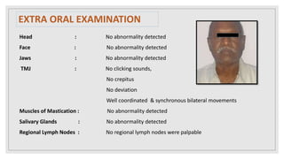 EXTRA ORAL EXAMINATION
Head : No abnormality detected
Face : No abnormality detected
Jaws : No abnormality detected
TMJ : No clicking sounds,
No crepitus
No deviation
Well coordinated & synchronous bilateral movements
Muscles of Mastication : No abnormality detected
Salivary Glands : No abnormality detected
Regional Lymph Nodes : No regional lymph nodes were palpable
 
