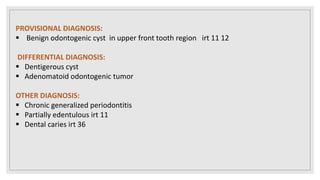 PROVISIONAL DIAGNOSIS:
 Benign odontogenic cyst in upper front tooth region irt 11 12
DIFFERENTIAL DIAGNOSIS:
 Dentigerous cyst
 Adenomatoid odontogenic tumor
OTHER DIAGNOSIS:
 Chronic generalized periodontitis
 Partially edentulous irt 11
 Dental caries irt 36
 