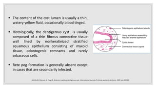  The content of the cyst lumen is usually a thin,
watery yellow fluid, occasionally blood tinged.
 Histologically, the dentigerous cyst is usually
composed of a thin fibrous connective tissue
wall lined by nonkeratinized stratified
squamous epithelium consisting of myxoid
tissue, odontogenic remnants and rarely
sebaceous cells.
 Rete peg formation is generally absent except
in cases that are secondarily infected.
Rohilla M, Marwah N, Tyagi R. Anterior maxillary dentigerous cyst. International journal of clinical pediatric dentistry. 2009 Jan;2(1):42.
 