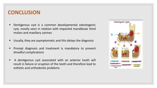  Dentigerous cyst is a common developmental odontogenic
cyst, mostly seen in relation with impacted mandibular third
molars and maxillary canines
 Usually, they are asymptomatic and this delays the diagnosis
 Prompt diagnosis and treatment is mandatory to prevent
dreadful complications
 A dentigerous cyst associated with an anterior tooth will
result in failure or eruption of the tooth and therefore lead to
esthetic and orthodontic problems
CONCLUSION
 