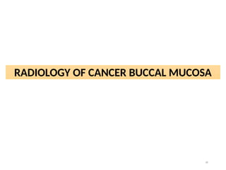 30
RADIOLOGY OF CANCER BUCCAL MUCOSA
 