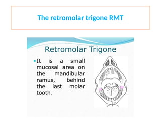The retromolar trigone RMT
 
